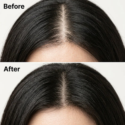 Restore, Rejuvenate, and Revive Your Scalp In DAYS With Korean Soap