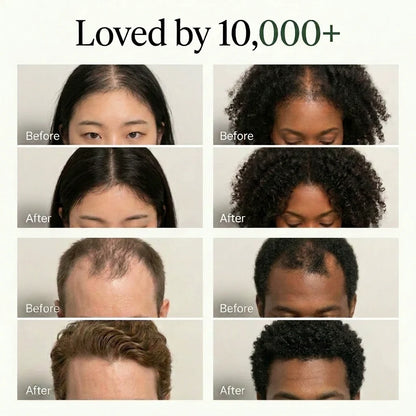 Restore, Rejuvenate, and Revive Your Scalp In DAYS With Korean Soap